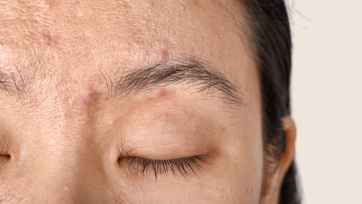 The Skincare Mistakes You Might Be Making Without Realising